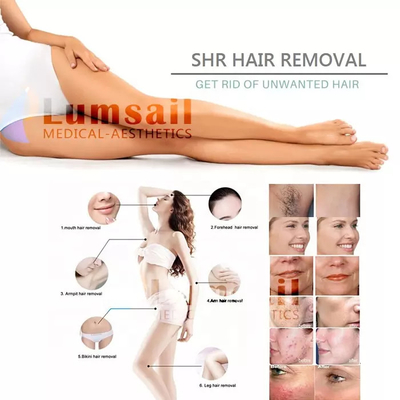 Schönheits-Salon-IPL gefrieren abkühlende Haut-Verjüngungs-Haar-Abbau-Laser-Maschine