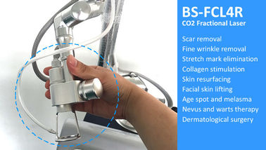 Kohlendioxyd CO2 Bruchlaser-Maschine für Haut-Narben-Behandlung