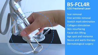 Bruchco2-Laser für Aknenarben