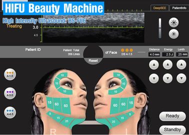 Schönheits-Maschine des hohe Intensitäts-fokussierte Ultraschall-HIFU für Gesichts-Behandlung im Schönheits-Salon