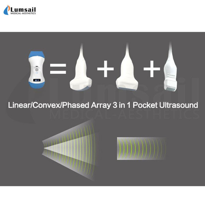 Linearer konvexer Körper in Phasen eingeteilt - Reihe 3 in 1 Handtaschen-Ultraschall-Scanner mit APP