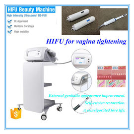 Nicht schmerzlosen Invasions-die HIFU-Schönheits-Maschinen-Ultraschallfokussierungsfrauen ziehen Vagina fest