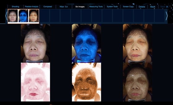 Spektrum 6 sehen klarere Haut-Problem-Gesichtshaut-Analyse-Ausrüstung