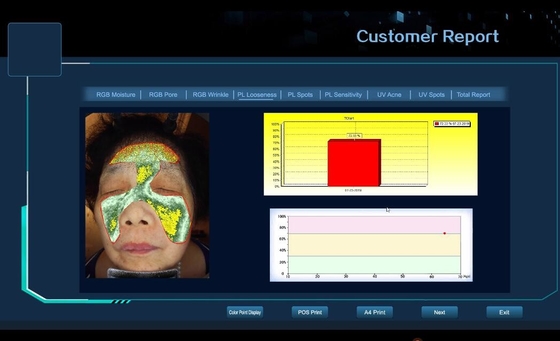 6 Spektrum-Berufshaut-Analysator-Gesichtsanalyse/Haut-Analysator/Haut-Analysator 3D