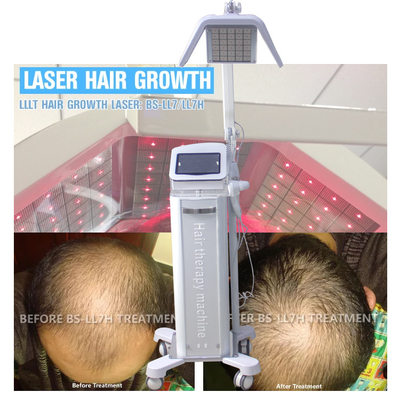 Energie-justierbare Haar-Laser-Wachstums-Maschine mit wirklichen Laserdioden der Wellenlängen-650nm/670nm