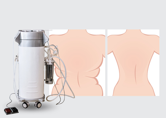chirurgische Maschine der Fettabsaugungs-300W für ober/untere hintere Fettabsaugung