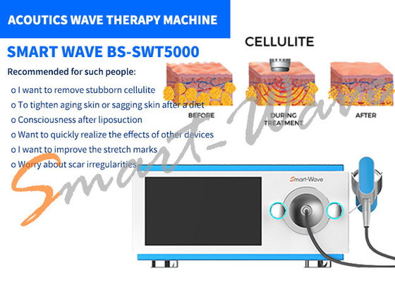 6 Übermittler-akustische Wellen-Therapie-Maschine für Dehnungsstreifen-Abbau/die Körper-Umgestaltung