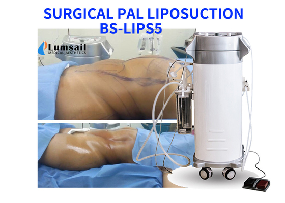 Chirurgische Fettabsaugungs-mit Ultraschallmaschine Kameraden, die Schönheits-Ausrüstung mit Cannula-Satz abnimmt