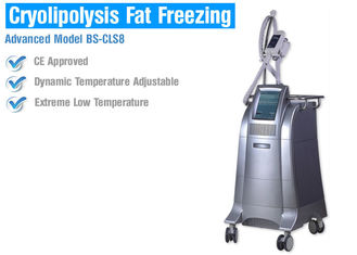 Körper-Abnehmen/, das fette Gefriehrmaschine Cryolipolysis mit intelligenter Temperaturüberwachung formt