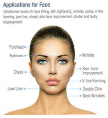 Haut, die HIFU-Schönheits-Maschinen-hohe Intensitäts-Ultraschall-Therapie für Schönheit festzieht