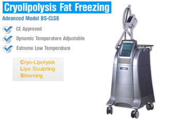 Körper-Abnehmen/, das fette Gefriehrmaschine Cryolipolysis mit intelligenter Temperaturüberwachung formt