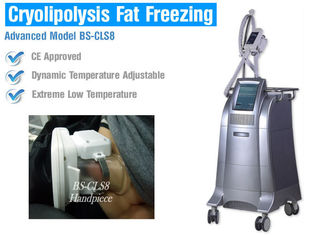 Nicht chirurgischer Fettabsaugung Cryolipolysis-Körper, der Maschine, Vakuumgewichtsverlust-Maschine abnimmt
