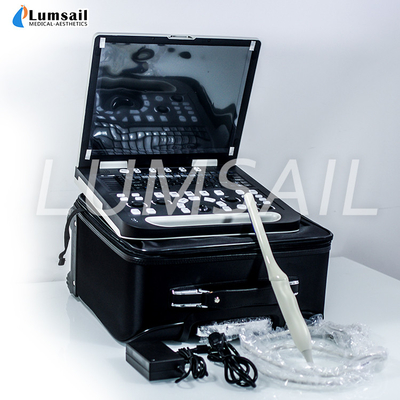 15 Zoll-voller Digital-Laptop-Ultraschall-Scanner-Doppler-Ultraschalldiagnosegerät
