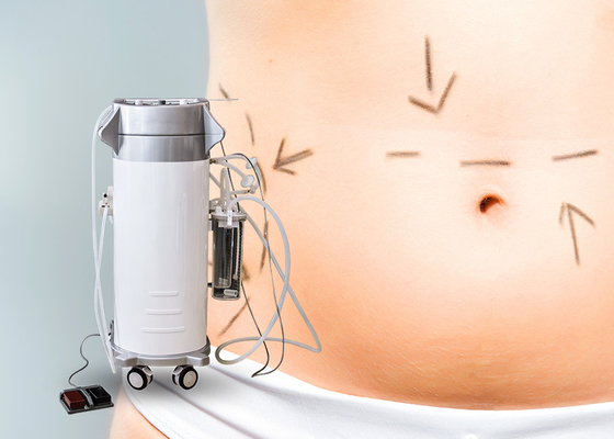 Sichere Hüfte Energie unterstützte Liposuction Maschine Hohe Fließfähigkeit für schnelle Fett-Ausschnitt