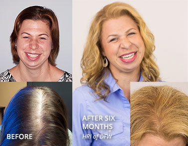 Dioden-Laser-Haar Regrowth-Gerät-Handsonden-Haar-wachsende Maschine für Friseursalon