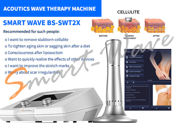 Akustische Wellen-Therapie-Maschine Cellulite-Abbau-1-jährige Garantie des Schönheits-Salon-BS-SWT2X